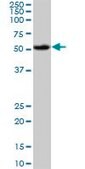 Monoclonal Anti-AKT1 antibody produced in mouse clone 2E11, purified immunoglobulin, buffered aqueous solution