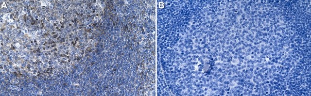 Anti-NFATc1 Antibody, clone 1O16 ZooMAb&#174; Rabbit Monoclonal recombinant, expressed in HEK 293 cells