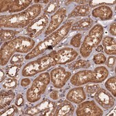 Anti-KIAA1468 antibody produced in rabbit Prestige Antibodies® Powered by Atlas Antibodies, affinity isolated antibody, buffered aqueous glycerol solution