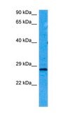 Anti-HPRT1 antibody produced in rabbit affinity isolated antibody