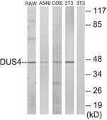 Anti-DUSP4 antibody produced in rabbit affinity isolated antibody