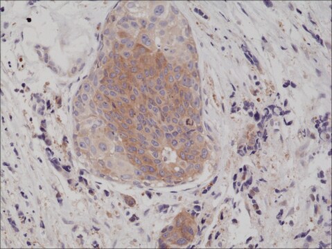 Anti-eIF-2 alpha (Ser51) antibody, Rabbit Monoclonal recombinant, expressed in HEK 293 cells, clone RM298, purified immunoglobulin