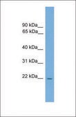 Anti-Rgs2 antibody produced in rabbit affinity isolated antibody