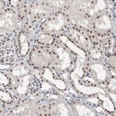 Anti-RBM6 antibody produced in rabbit Prestige Antibodies® Powered by Atlas Antibodies, affinity isolated antibody, buffered aqueous glycerol solution, Ab1