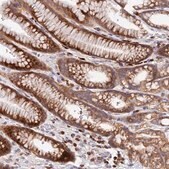 Anti-CCT6A antibody produced in rabbit Prestige Antibodies&#174; Powered by Atlas Antibodies, affinity isolated antibody, buffered aqueous glycerol solution