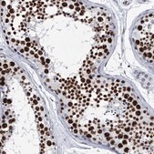 Anti-SIM2 antibody produced in rabbit Prestige Antibodies® Powered by Atlas Antibodies, affinity isolated antibody, buffered aqueous glycerol solution