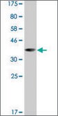Monoclonal Anti-LHX5 antibody produced in mouse clone 1D9, ascites fluid