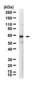 Anti-δ Tubulin Antibody, clone 1B20 ZooMAb® Rabbit Monoclonal recombinant, expressed in HEK 293 cells