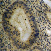 Anti-phospho-Tau (pThr212) antibody produced in rabbit affinity isolated antibody