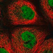 Anti-REXO1 antibody produced in rabbit Prestige Antibodies&#174; Powered by Atlas Antibodies, affinity isolated antibody, buffered aqueous glycerol solution