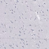 Monoclonal Anti-GZMB antibody produced in mouse Prestige Antibodies® Powered by Atlas Antibodies, clone CL10662, purified antibody (Protein A)