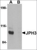 Anti-JPH3 antibody produced in rabbit affinity isolated antibody, buffered aqueous solution