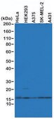 Anti-Histone H2AZ antibody, Rabbit monoclonal recombinant, expressed in HEK 293 cells, clone RM215, purified immunoglobulin