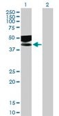 Anti-IL1R2 antibody produced in mouse IgG fraction of antiserum, buffered aqueous solution
