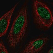 Anti-SS18 antibody produced in rabbit Prestige Antibodies&#174; Powered by Atlas Antibodies, affinity isolated antibody, buffered aqueous glycerol solution