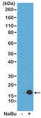 Anti-Acetyl-Histone H3 (Lys4) antibody, Rabbit monoclonal recombinant, expressed in HEK 293 cells, clone RM149, purified immunoglobulin