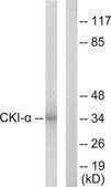 Anti-CKI-α antibody produced in rabbit affinity isolated antibody
