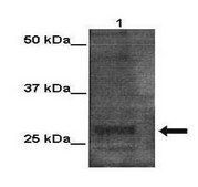 Anti-RAD51 antibody produced in rabbit affinity isolated antibody