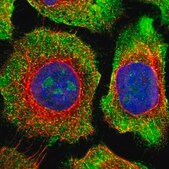 Anti-ZNF800 antibody produced in rabbit Prestige Antibodies&#174; Powered by Atlas Antibodies, affinity isolated antibody, buffered aqueous glycerol solution