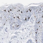 抗-CD207 兔抗 Prestige Antibodies&#174; Powered by Atlas Antibodies, affinity isolated antibody, buffered aqueous glycerol solution