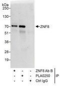 Rabbit anti-ZNF8 Antibody, Affinity Purified Powered by Bethyl Laboratories, Inc.