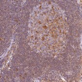 Anti-GPX1 antibody produced in rabbit Prestige Antibodies® Powered by Atlas Antibodies, affinity isolated antibody, buffered aqueous glycerol solution