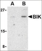 Anti-BIK antibody produced in rabbit affinity isolated antibody, buffered aqueous solution