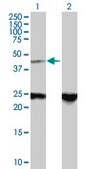 Anti-ZNF24 antibody produced in mouse purified immunoglobulin, buffered aqueous solution