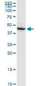Anti-DSCC1 antibody produced in mouse purified immunoglobulin, buffered aqueous solution