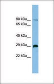 Anti-C1ORF77 antibody produced in rabbit affinity isolated antibody