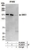 Goat anti-SMC1 Antibody, Affinity Purified Powered by Bethyl Laboratories, Inc.