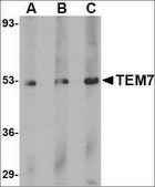 Anti-TEM7 antibody produced in rabbit affinity isolated antibody, buffered aqueous solution