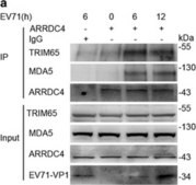 抗-TRIM65 兔抗 Prestige Antibodies® Powered by Atlas Antibodies, affinity isolated antibody, buffered aqueous glycerol solution, Ab2