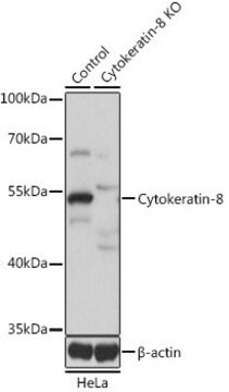 Anti-KRT8 antibody produced in rabbit