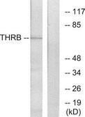 Anti-THRB antibody produced in rabbit affinity isolated antibody