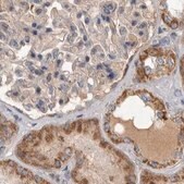 Anti-SCO1 antibody produced in rabbit Prestige Antibodies&#174; Powered by Atlas Antibodies, affinity isolated antibody, buffered aqueous glycerol solution, Ab2