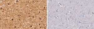 Anti-DCTN1 Antibody, clone 2B11 ZooMAb® Rabbit Monoclonal recombinant, expressed in HEK 293 cells