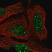 Anti-FBXO48 antibody produced in rabbit Prestige Antibodies&#174; Powered by Atlas Antibodies, affinity isolated antibody, buffered aqueous glycerol solution