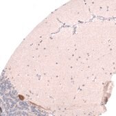 Monoclonal Anti-PTN antibody produced in mouse Prestige Antibodies® Powered by Atlas Antibodies, clone CL15628, purified antibody (Protein A)