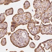 Anti-ARHGAP26 antibody produced in rabbit Prestige Antibodies&#174; Powered by Atlas Antibodies, affinity isolated antibody, buffered aqueous glycerol solution