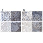 Anti-ITGB2 antibody produced in rabbit Prestige Antibodies&#174; Powered by Atlas Antibodies, affinity isolated antibody, buffered aqueous glycerol solution