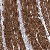 Anti-AFTPH antibody produced in rabbit Prestige Antibodies&#174; Powered by Atlas Antibodies, affinity isolated antibody, buffered aqueous glycerol solution