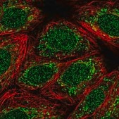 Anti-TMEM223 antibody produced in rabbit Prestige Antibodies® Powered by Atlas Antibodies, affinity isolated antibody, buffered aqueous glycerol solution