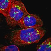 Anti-SLC35E1 antibody produced in rabbit Prestige Antibodies&#174; Powered by Atlas Antibodies, affinity isolated antibody, buffered aqueous glycerol solution