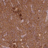 Anti-MRRF antibody produced in rabbit Prestige Antibodies&#174; Powered by Atlas Antibodies, affinity isolated antibody, buffered aqueous glycerol solution