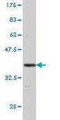 Monoclonal Anti-GFI1 antibody produced in mouse clone 3G8, purified immunoglobulin, buffered aqueous solution