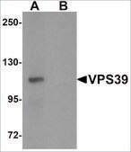 Anti-VPS39 antibody produced in rabbit affinity isolated antibody