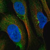 Anti-BROX antibody produced in rabbit Prestige Antibodies® Powered by Atlas Antibodies, affinity isolated antibody, buffered aqueous glycerol solution