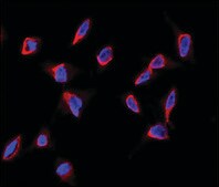 Anti-SHB (center) antibody produced in rabbit saturated ammonium sulfate (SAS) precipitated, buffered aqueous solution