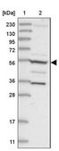 Anti-FAM114A2 antibody produced in rabbit Prestige Antibodies® Powered by Atlas Antibodies, affinity isolated antibody, buffered aqueous glycerol solution